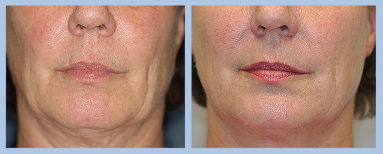 Centre De Dermatologie Eureka Castelnau Le Lez